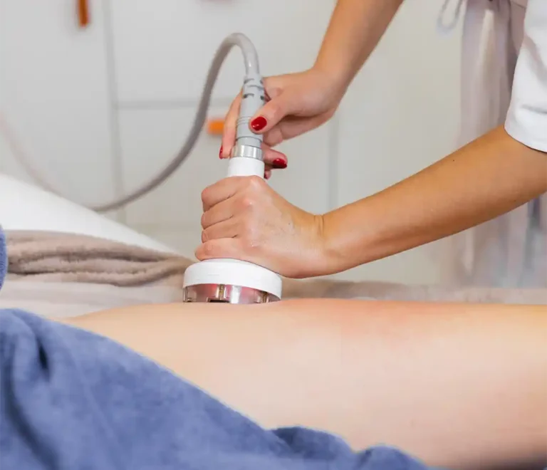 Cellulite Removal Treatments